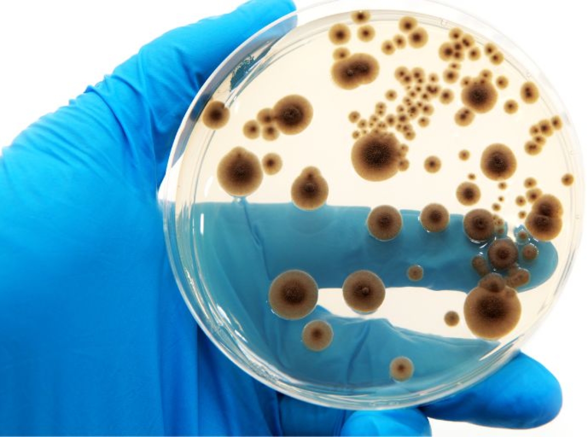 Nueva norma para la validación de métodos de identificación microbiana en alimentos