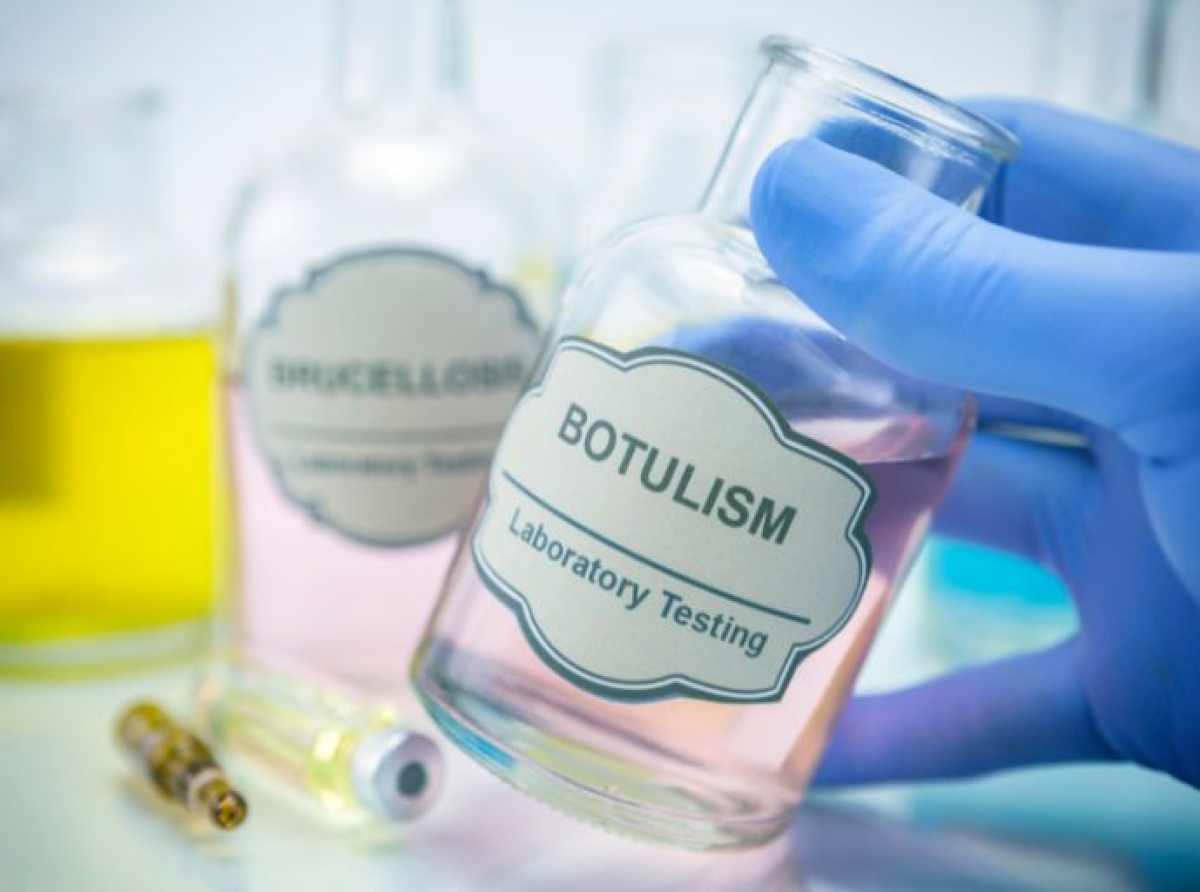 Italia registra una cuarta muerte por botulismo debido a un brote por intoxicación alimentaria